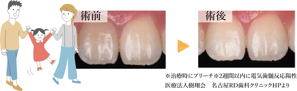 症例