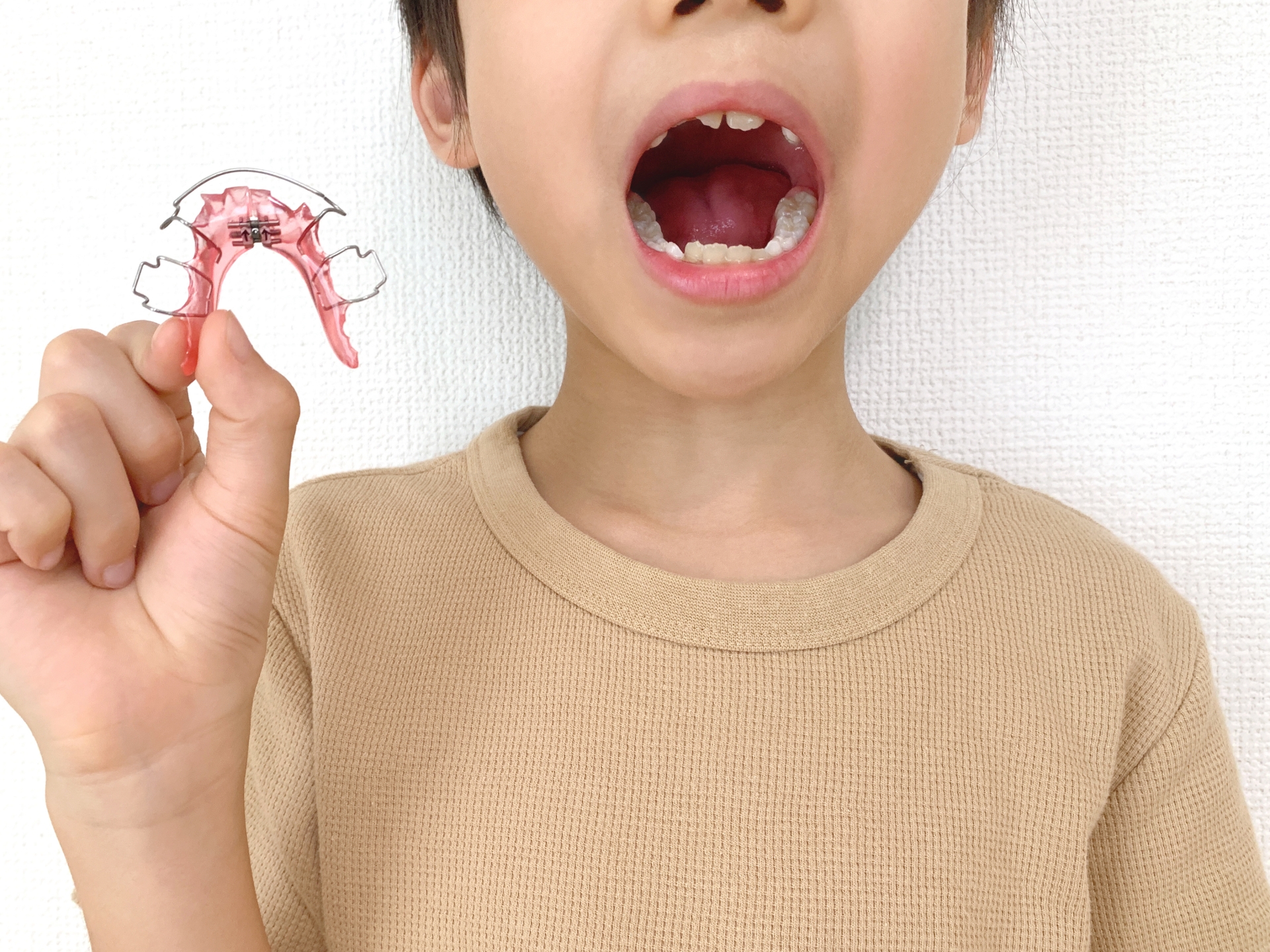 子供の歯並びは自然に治る？